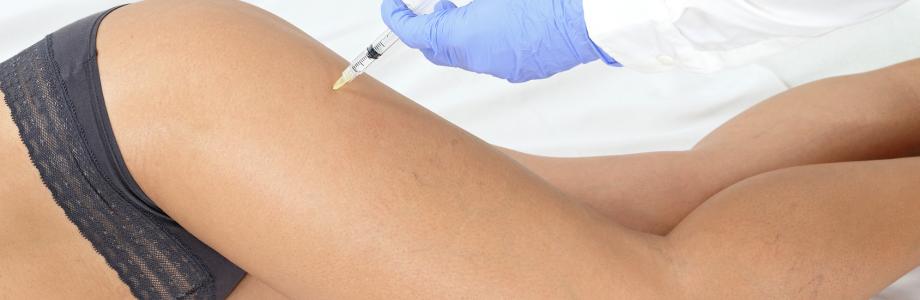 Tutti i segreti della mesoterapia